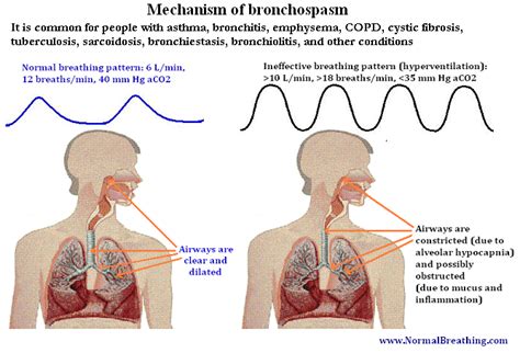 Bronchospasm: Symptoms, Causes, and Treatment.